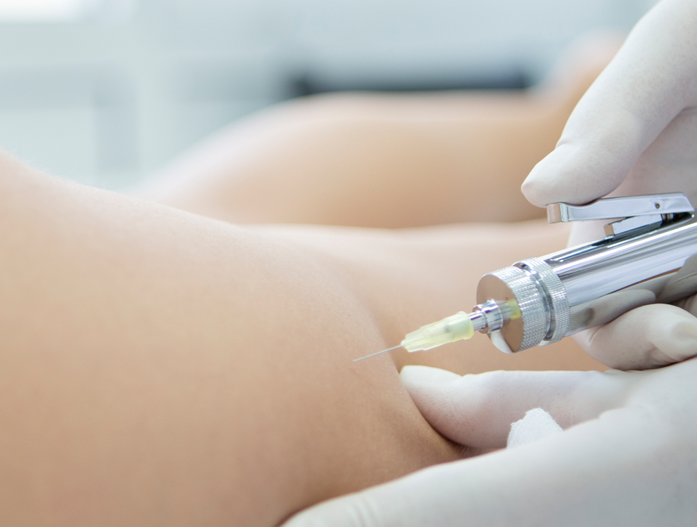 Mobile Ansicht: Themenbild von Körperbehandlungen