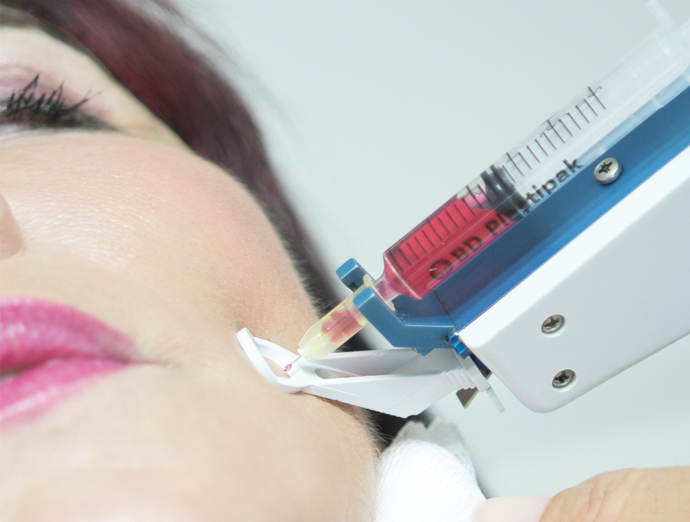 Mobile Ansicht Silderbild: Mesotherapie