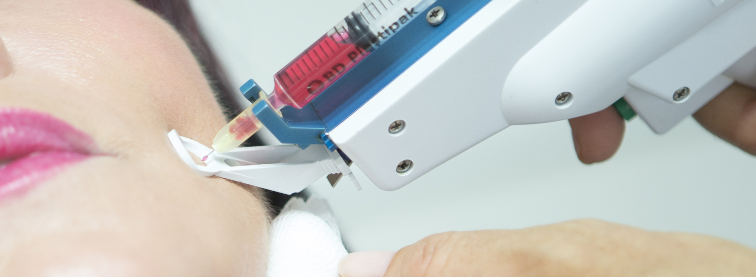 Silderbild: Mesotherapie