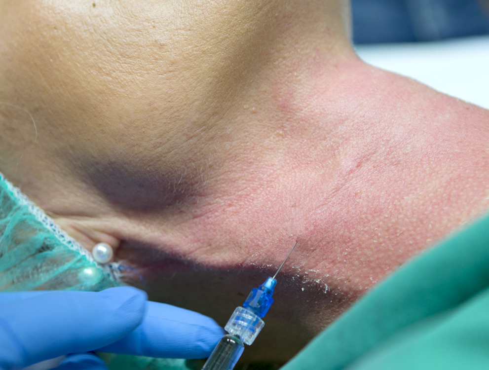 Mobile Anischt:Themenbild von Gewebe Volumenaufbau