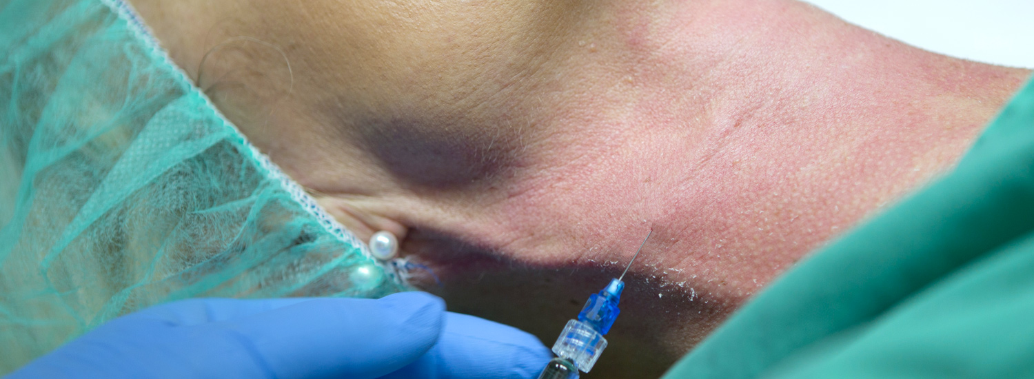 Themenbild von Gewebe Volumenaufbau