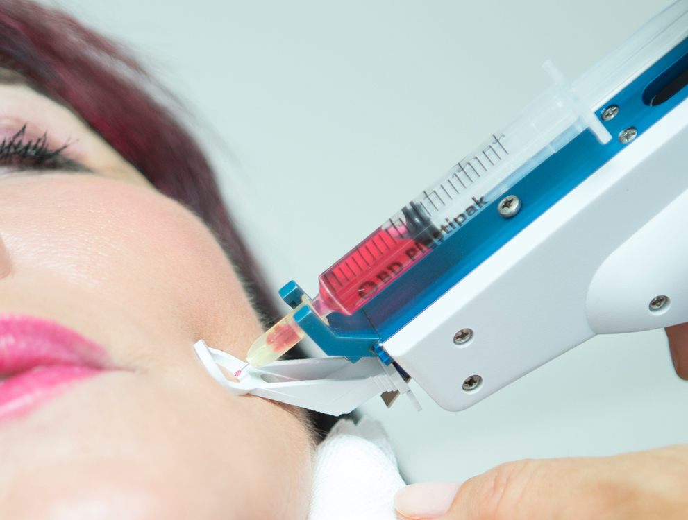 Mobile Ansicht: Themenbild von Mesotherapie