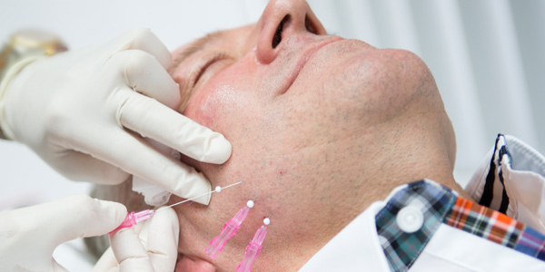 Teaserbild für Faltenbehandlung