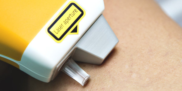 Teaserbild für Laser, Radiofrequenz