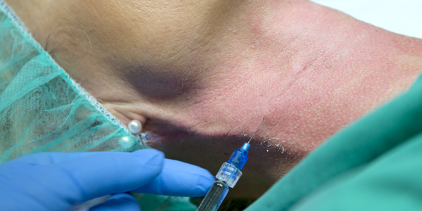 Teaserbild für Gewebe Volumenaufbau