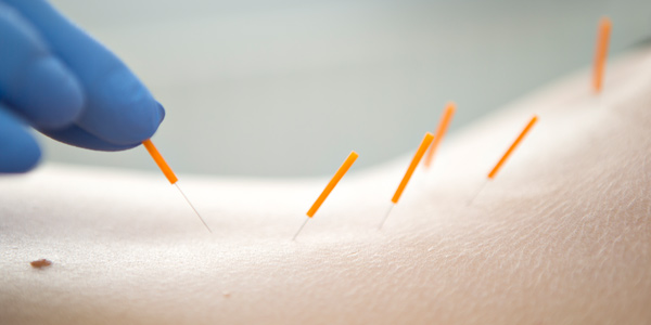 Teaserbild für Alternative Medizin und Komplementäre Medizin