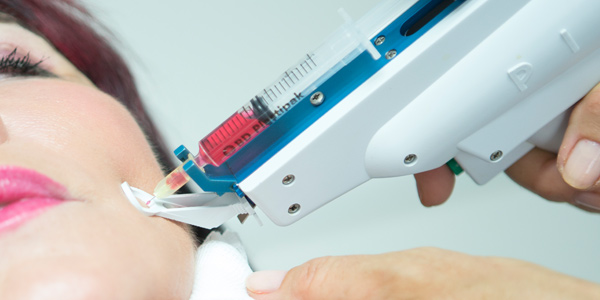 Teaserbild für Mesotherapie